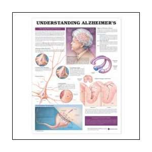  Understanding Alzheimers Anatomical Chart 20 X 26 