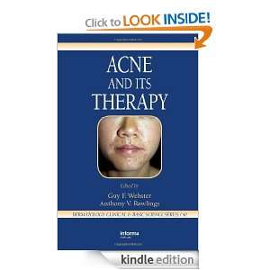 Acne and Its Therapy (Basic and Clinical Dermatology) Guy F. Webster 