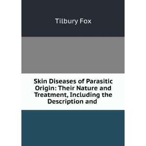   and Treatment, Including the Description and .: Tilbury Fox: Books